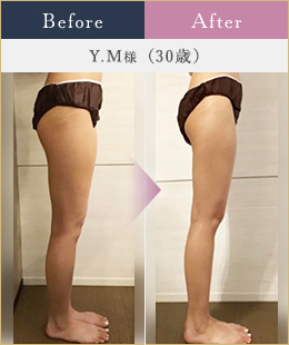 施術例2