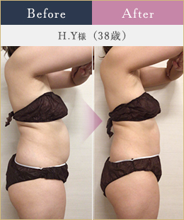 施術例1