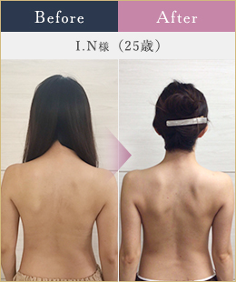 施術例2
