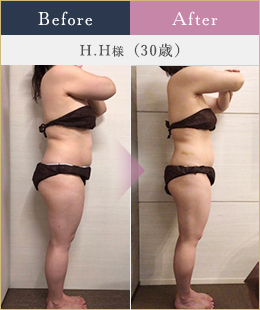 施術例4