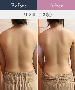施術例5