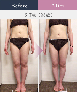 施術例8